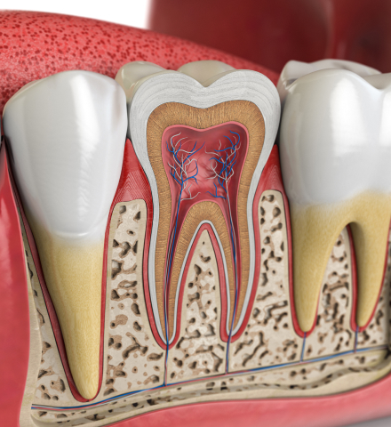 model of tooth pulp